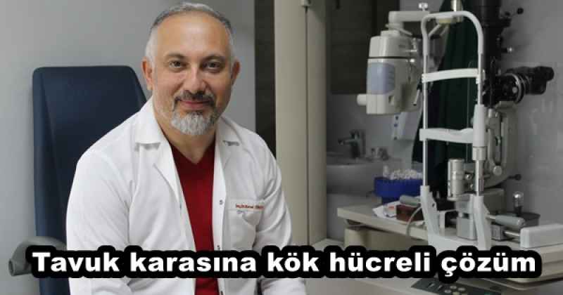 Tavuk karasına kök hücreli çözüm  